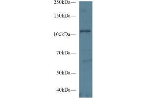Western Blotting (WB) image for anti-Ephrin Type A Receptor 1 (EPHA1) (AA 716-960) antibody (ABIN1858726)