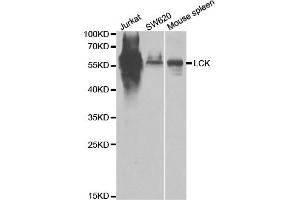 Western blot analysis of extracts of various cell lines, using LCK antibody (ABIN5971204) at 1/1000 dilution. (LCK Antikörper)