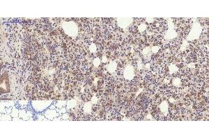 Immunohistochemistry of paraffin-embedded Rat lung tissue using YAP1 Polyclonal Antibody at dilution of 1:200. (YAP1 Antikörper)