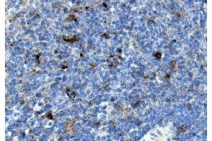 IHC analysis of Ccr2 using anti-Ccr2 antibody (ABIN7602745). (CCR2 Antikörper  (C-Term))
