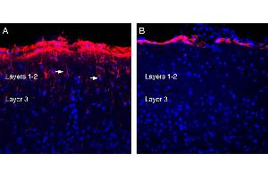 Expression of GFAP in rat parietal cortex. (Glial Fibrillary Acidic Protein (GFAP) Peptid)