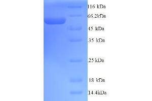 SDS-PAGE (SDS) image for Preferentially Expressed Antigen in Melanoma (PRAME) (AA 1-509), (full length) protein (His tag) (ABIN5713748) (PRAME Protein (AA 1-509, full length) (His tag))