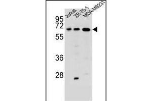 ZSCAN2 Antibody (N-term) (ABIN657010 and ABIN2846190) western blot analysis in Jurkat,ZR-75-1,MDA-M cell line lysates (35 μg/lane). (ZSCAN2 Antikörper  (N-Term))