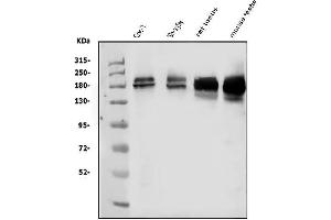 Western blot analysis of KDM5B using anti-KDM5B antibody (ABIN4886648). (KDM5B Antikörper  (Middle Region))