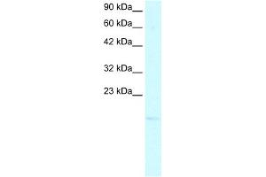 WB Suggested Anti-PC4 Antibody Titration:  2. (SUB1 Antikörper  (N-Term))