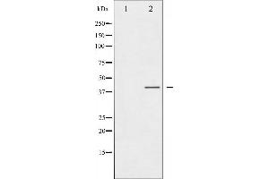 Western blot analysis of CCR5 phosphorylation expression in Jurkat whole cell lysates,The lane on the left is treated with the antigen-specific peptide. (CCR5 Antikörper  (pSer336))