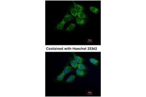 ICC/IF Image Immunofluorescence analysis of methanol-fixed Hep3B, using HSD17B4, antibody at 1:500 dilution. (HSD17B4 Antikörper)