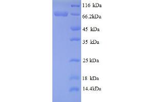 SDS-PAGE (SDS) image for Hydroxyacid Oxidase (Glycolate Oxidase) 1 (HAO1) (AA 23-604), (partial) protein (His tag) (ABIN5710758) (HAO1 Protein (AA 23-604, partial) (His tag))