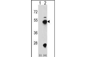 Western blot analysis of FDPS (arrow) using rabbit polyclonal FDPS Antibody (D31) (ABIN1882080 and ABIN2839262). (FDPS Antikörper  (N-Term))