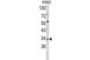 Western Blotting (WB) image for anti-Secreted Frizzled-Related Protein 5 (SFRP5) antibody (ABIN3002916) (SFRP5 Antikörper)