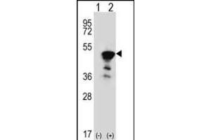 Western blot analysis of FEN1 (arrow) using rabbit polyclonal FEN1 Antibody (Center) (ABIN389376 and ABIN2839472). (FEN1 Antikörper  (AA 243-272))