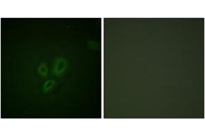 Immunofluorescence analysis of HepG2 cells, using TNNI3 (Ab-22/23) Antibody.