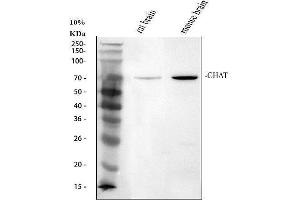 Western blot analysis of Chat using anti-Chat antibody (ABIN7600421).