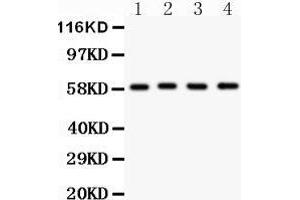 Anti- G6PD antibody, Western blotting All lanes: Anti G6PD  at 0. (Glucose-6-Phosphate Dehydrogenase Antikörper  (AA 315-515))
