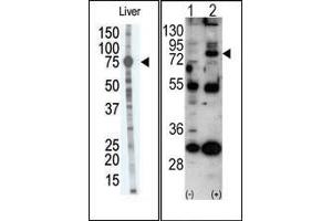 Image no. 1 for anti-Matrix Metallopeptidase 9 (Gelatinase B, 92kDa Gelatinase, 92kDa Type IV Collagenase) (MMP9) (C-Term) antibody (ABIN358703)