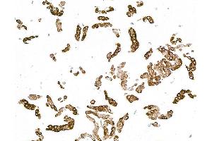 Immunocytochemistry (ICC) image for anti-Keratin 14 (KRT14) (C-Term) antibody (ABIN7795697)