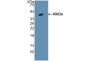 Detection of Recombinant KRT18, Rat using Polyclonal Antibody to Cytokeratin 18 (CK18) (Cytokeratin 18 Antikörper  (AA 72-380))