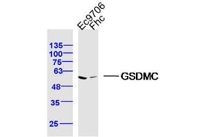 Lane 1: Ec9706 lysates Lane 2: FHC lysates probed with GSDMC Polyclonal Antibody, Unconjugated  at 1:300 dilution and 4˚C overnight incubation. (MLZE Antikörper  (AA 1-100))