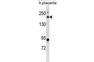 BCL9L Antibody (N-term) (ABIN1881110 and ABIN2838843) western blot analysis in human placenta tissue lysates (35 μg/lane). (BCL9L Antikörper  (N-Term))