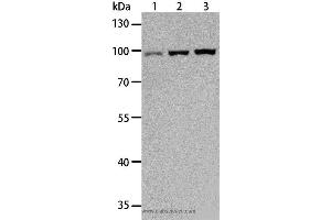 Western blot analysis of Hela, Raji and K562 cell, using TLR3 Polyclonal Antibody at dilution of 1:500 (TLR3 Antikörper)