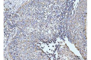 IHC analysis of GRPEL1 using anti-GRPEL1 antibody (ABIN7602643).