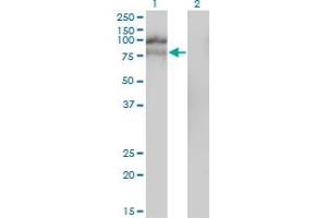 Western Blot analysis of HGS expression in transfected 293T cell line by HGS monoclonal antibody (M01), clone 6D11. (HGS Antikörper  (AA 513-612))