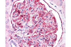 Immunohistochemistry (IHC) image for anti-Vimentin (VIM) (C-Term) antibody (ABIN2783289) (Vimentin Antikörper  (C-Term))