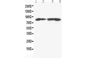 Anti-MTA1 antibody, Western blotting Lane 1: MCF-7 Cell Lysate Lane 2: HELA Cell Lysate Lane 3: JURKAT Cell Lysate Lane 4: CEM Cell Lysate