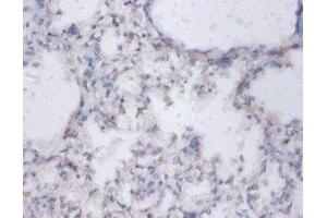 IHC analysis of paraffin-embedded human lung tissue using Diamine acetyltransferase 1 Antibody (1/100 dilution). (SAT1 Antikörper  (AA 5-171))