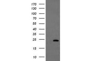 HEK293T cells were transfected with the pCMV6-ENTRY control (Left lane) or pCMV6-ENTRY UBE2E3 (Right lane) cDNA for 48 hrs and lysed. (UBE2E3 Antikörper)