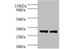 Western blot All lanes: HLA-DPA1 antibody at 2 μg/mL Lane 1: 293T whole cell lysate Lane 2: HepG2 whole cell lysate Secondary Goat polyclonal to rabbit IgG at 1/10000 dilution Predicted band size: 30 kDa Observed band size: 30 kDa (HLA-DPA1 Antikörper  (AA 29-222))