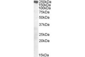 Western Blotting (WB) image for anti-Sortilin-Related Receptor, L(DLR Class) A Repeats Containing (SORL1) (AA 2203-2214) antibody (ABIN297696) (SORL1 Antikörper  (AA 2203-2214))