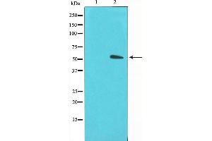 Western blot analysis on LOVO cell lysate using GLUT3 Antibody,The lane on the left is treated with the antigen-specific peptide. (SLC2A3 Antikörper  (C-Term))