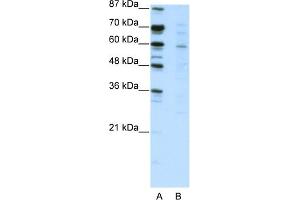 WB Suggested Anti-CBFA2T3 Antibody Titration:  2. (CBFA2T3 Antikörper  (N-Term))