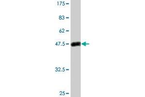 Western Blot detection against Immunogen (50. (PSPH Antikörper  (AA 1-225))