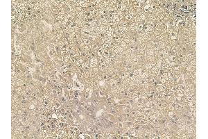 ABIN6256818 and ABIN6267197 at 1/100 staining human normal liver tissue by IHC-P. (TEK Antikörper  (pTyr992))
