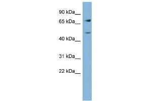 WB Suggested Anti-GFPT2 Antibody Titration:  0. (GFPT2 Antikörper  (Middle Region))