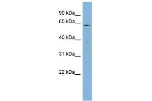 Western Blotting (WB) image for anti-Cytochrome P450, Family 4, Subfamily F, Polypeptide 3 (CYP4F3) (N-Term) antibody (ABIN2777012)