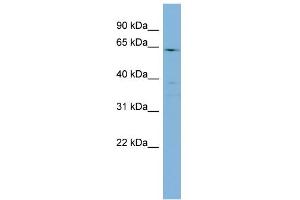 WB Suggested Anti-CYP4F3 Antibody Titration:  0.