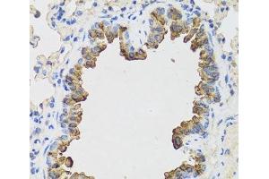 Immunohistochemistry of paraffin-embedded Mouse lung using B9D1 Polyclonal Antibody at dilution of 1:100 (40x lens). (B9D1 Antikörper)