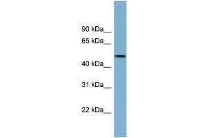 Human 721_B; WB Suggested Anti-ACTR3B Antibody Titration: 0. (ACTR3B Antikörper  (N-Term))
