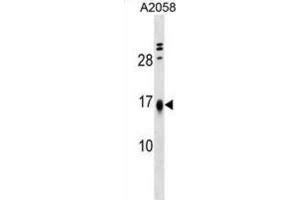 Western Blotting (WB) image for anti-Limb-Bud and Heart (LBH) antibody (ABIN5019448) (LBH Antikörper)