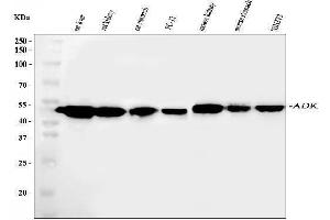 Western blot analysis of ADK using anti-ADK antibody (ABIN4886430). (ADK Antikörper  (AA 165-351))