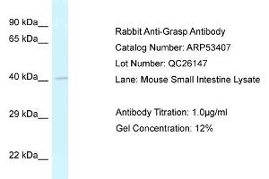 Western Blotting (WB) image for anti-GRP1 (General Receptor For phosphoinositides 1)-Associated Scaffold Protein (GRASP) (N-Term) antibody (ABIN2785380) (Tamalin/GRASP Antikörper  (N-Term))
