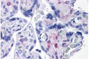 Human Placenta: Formalin-Fixed, Paraffin-Embedded (FFPE) (PLAC1 Antikörper  (C-Term))