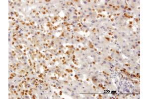 Immunoperoxidase of monoclonal antibody to TARS on formalin-fixed paraffin-embedded human liver.
