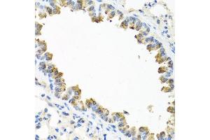 Immunohistochemistry of paraffin-embedded mouse lung using TICAM1 antibody at dilution of 1:100 (40x lens). (TICAM1 Antikörper)