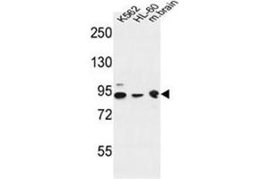 Western blot analysis of DNAJC6 Antibody  in K562, HL-60 cell line and mouse brain tissue lysates (35ug/lane).