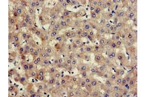 Immunohistochemistry of paraffin-embedded human liver tissue using ABIN7154998 at dilution of 1:100 (Hemopexin Antikörper  (AA 32-254))