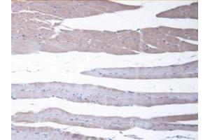 IHC-P analysis of Mouse Skeletal Muscle Tissue, with DAB staining. (CBR1 Antikörper  (AA 66-271))